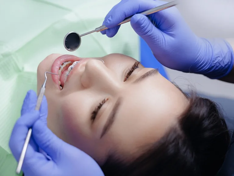 Invisalign clear aligners treatment